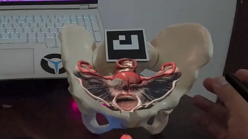 Mixed-Reality Anatomy Overlay demo